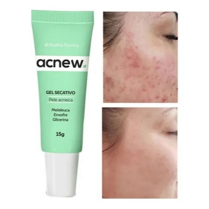 Acnew Gel Secativo – Abelha Rainha