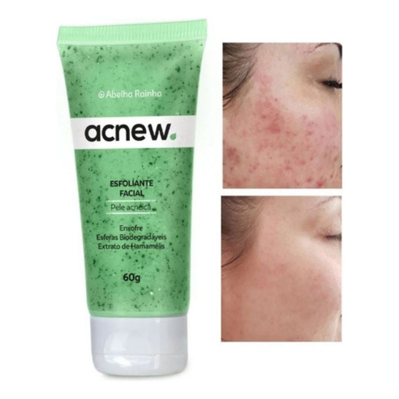 Acnew Esfoliante Facial – Abelha Rainha