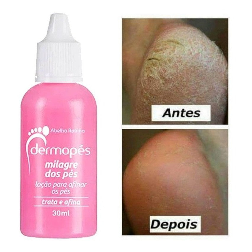 Loção para Pés Dermopés Abelha Rainha 30ml