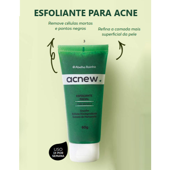 Kit Tratamento de Acne Completo Controle de Oleosidade Controle Oleosidade Espinhas Cravos