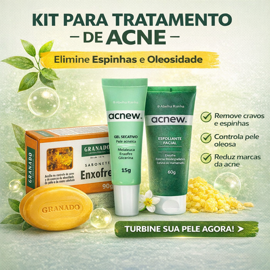 Kit Tratamento de Acne Completo Controle de Oleosidade Controle Oleosidade Espinhas Cravos